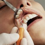 Benefits of Having a Good Dental Care