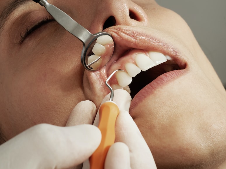 Benefits of Having a Good Dental Care